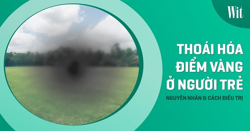 Thoái hóa điểm vàng ở người trẻ