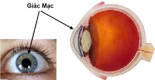 cải thiện viêm loét giác mạc