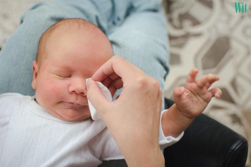chăm sóc mắt sau phẫu thuật