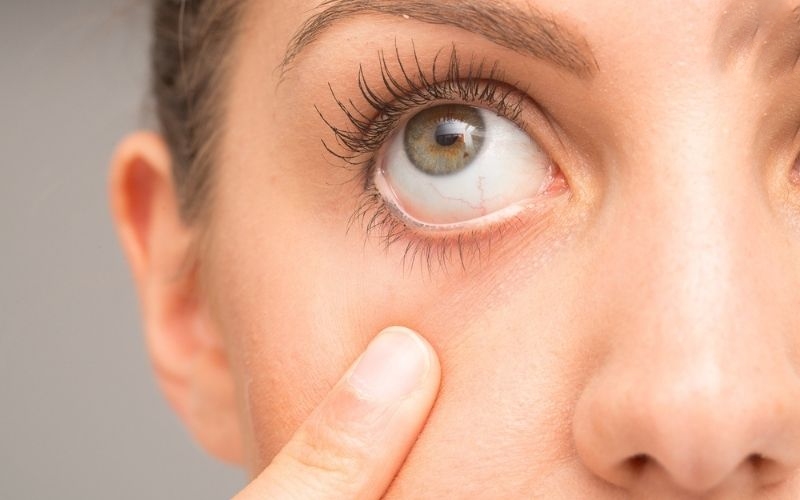 dấu hiệu biến chứng sau mổ cận