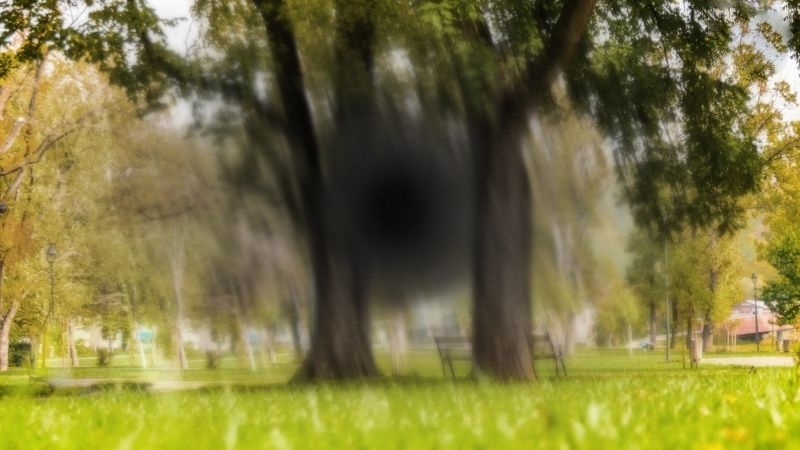 thoái hóa điểm vàng thể ướt