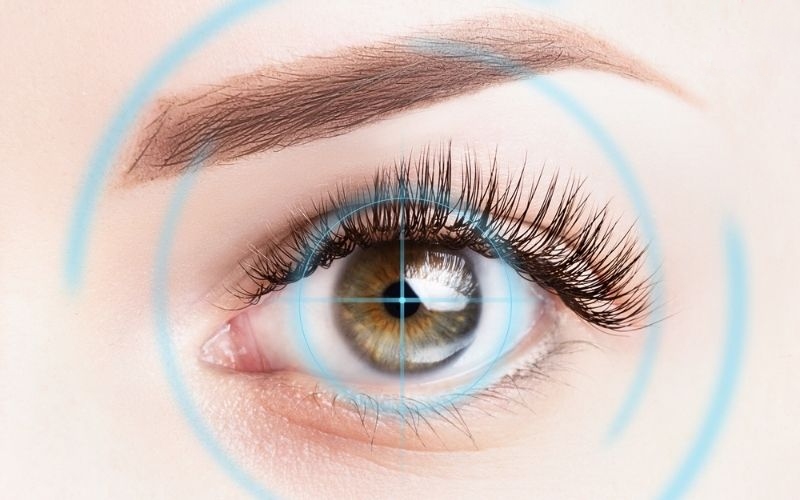 tái cận sau mổ lasik