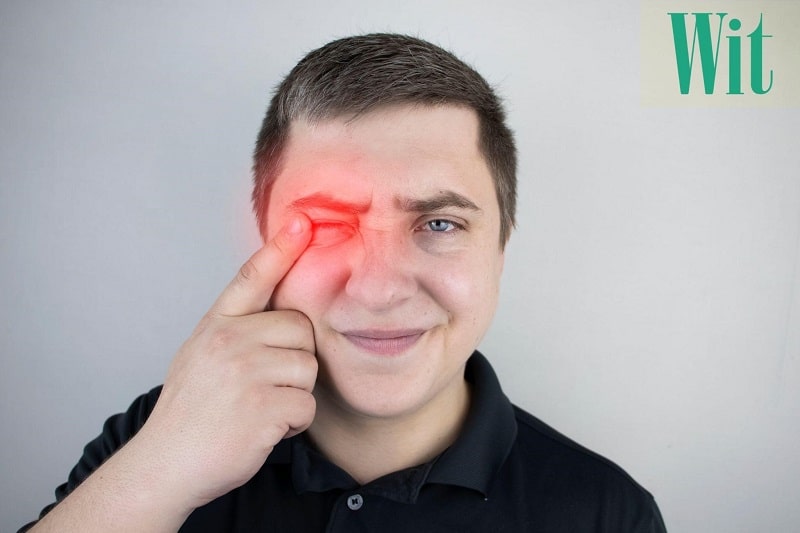 Mí mắt bị sưng: Nguyên nhân và cách cải thiện hiệu quả