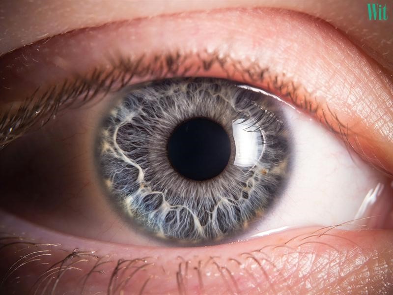 5 dấu hiệu ung thư võng mạc mắt cần nhận biết sớm