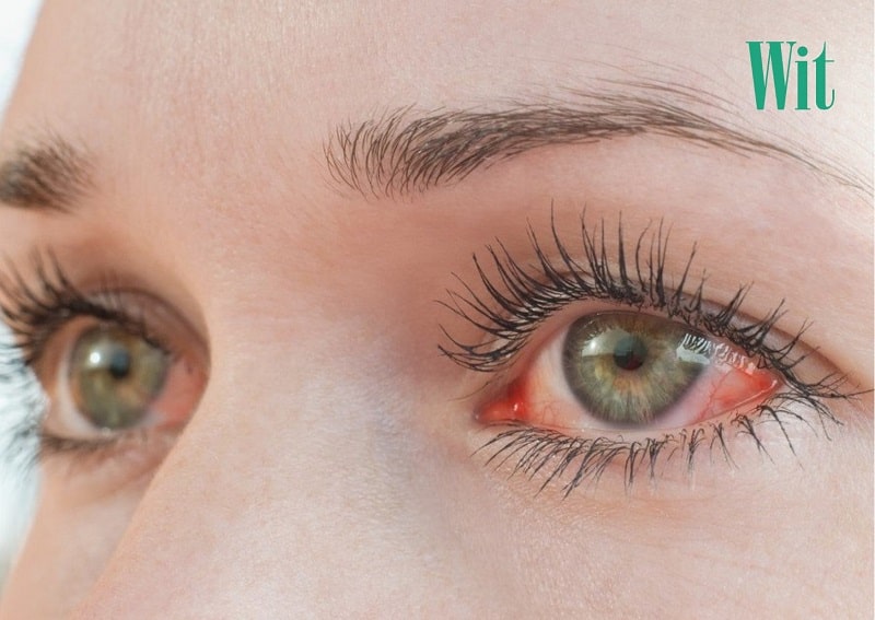 ngứa mắt trái theo giờ