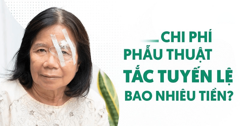 chi phí phẫu thuật tắc tuyến lệ