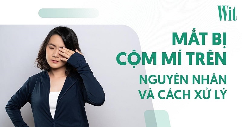 Mắt bị cộm mí trên