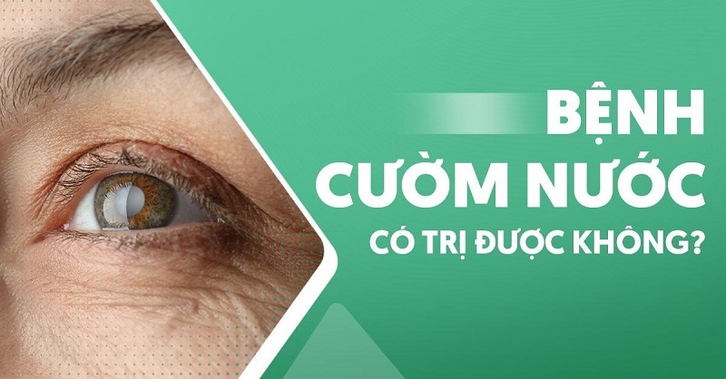 Bệnh cườm nước có trị được không? Khỏi hoàn toàn không?