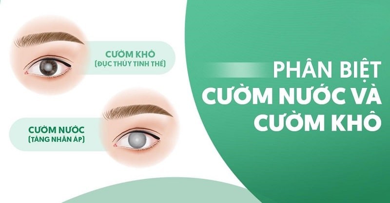 Cườm nước và cườm khô: Phân biệt như thế nào?