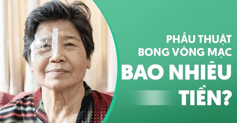 Bảng giá phẫu thuật bong võng mạc bao nhiêu tiền?
