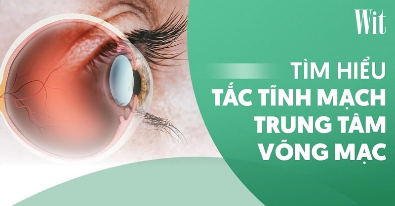 Tắc tĩnh mạch trung tâm võng mạc