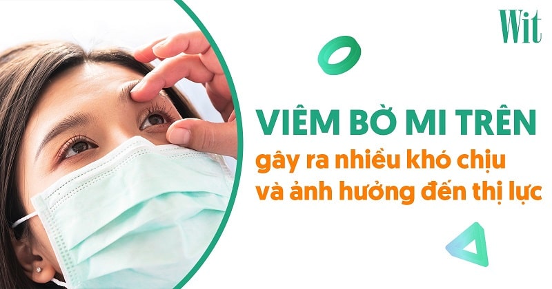 Viêm bờ mi mắt trên: Nguyên nhân, dấu hiệu và cách điều trị