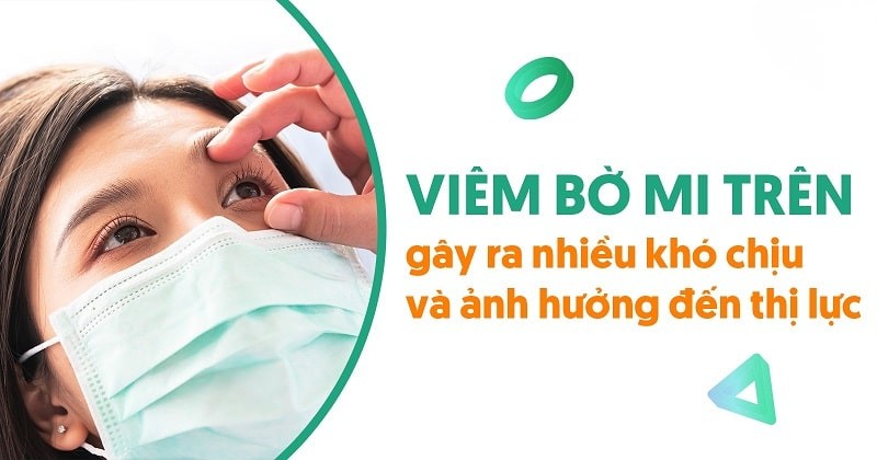 Viêm bờ mi mắt trên: Nguyên nhân, dấu hiệu và cách điều trị