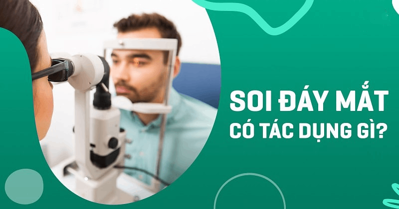 soi đáy mắt có tác dụng gì