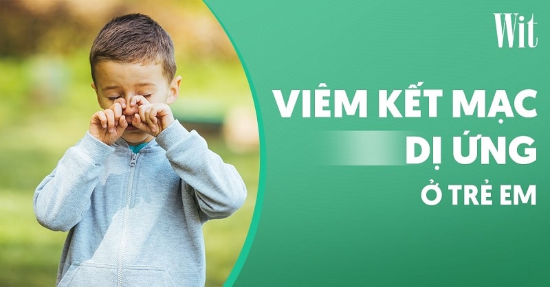 Viêm kết mạc dị ứng ở trẻ em: Nguyên nhân, dấu hiệu và điều trị