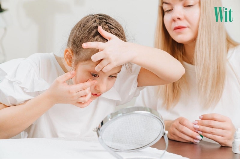 Chỉnh hình giác mạc tạm thời bằng Ortho-K