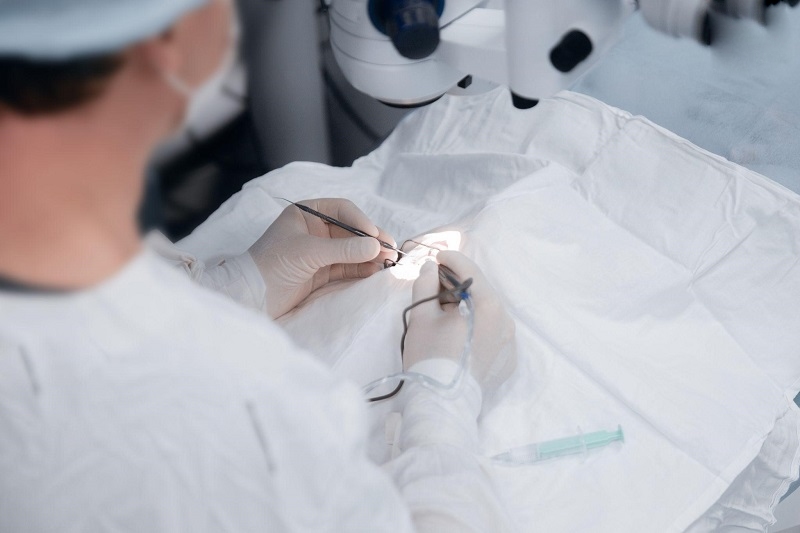 phẫu thuật thay thủy tinh thể