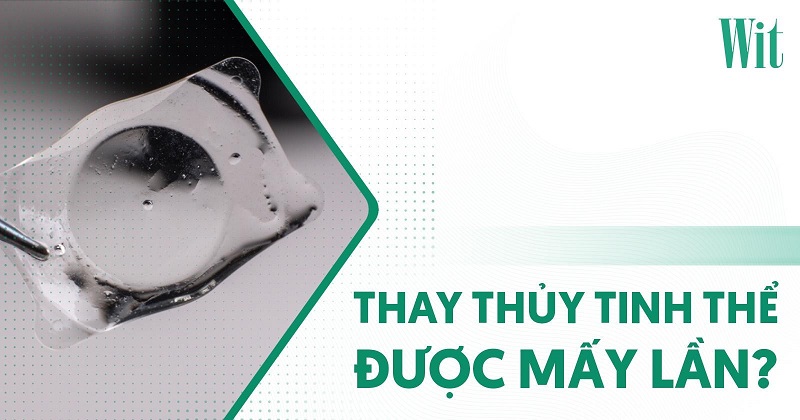 Thay thủy tinh thể được mấy lần