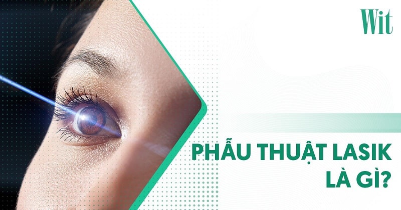phẫu thuật lasik