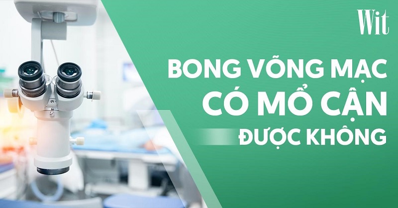 Bong võng mạc có mổ cận được không? Phòng ngừa như thế nào?