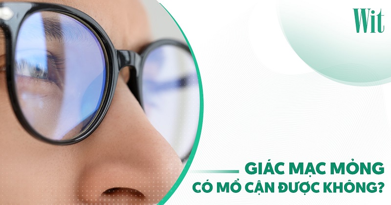 Giác mạc mỏng có mổ cận được không