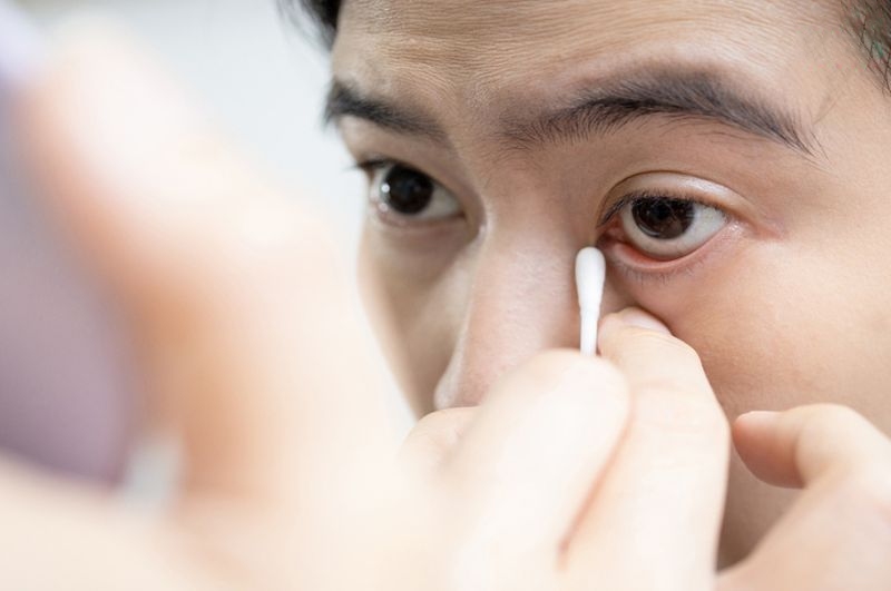 dùng tăm bông vệ sinh mắt