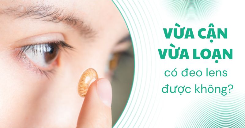 vừa cận vừa loạn có đeo lens được không