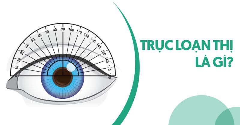 Trục loạn thị càng lớn càng nguy hiểm? Phòng ngừa ra sao?