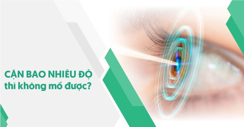 cận bao nhiêu độ thì không mổ được