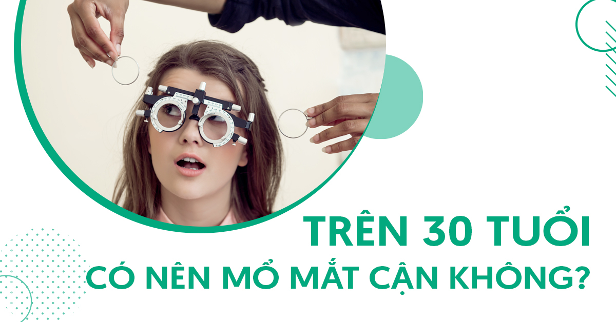 trên 30 tuổi có nên mổ mắt cận không