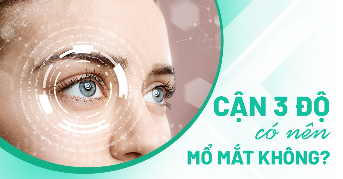 cận 3 độ có nên mổ mắt không
